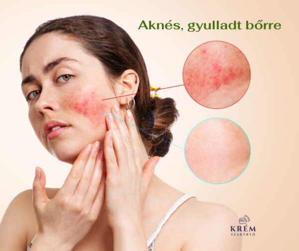 Skin Normalizing Cream Rejuvi .